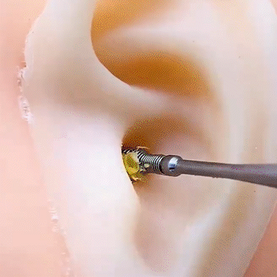 🔥Big Sale only $9.99 !!! 🔥 6 Counts Ear Wax Removal Tool Set with Storage Tube